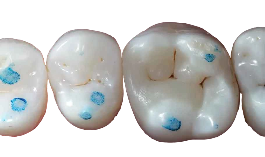 SuperEndo Dental Articulating Paper 100um Blue (Pack of 240)