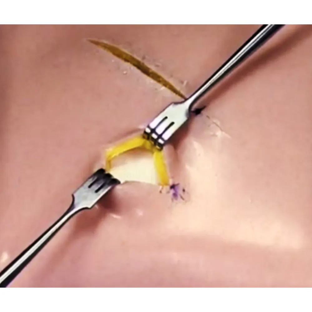 Oracraft Appuntito Tissue Retractor