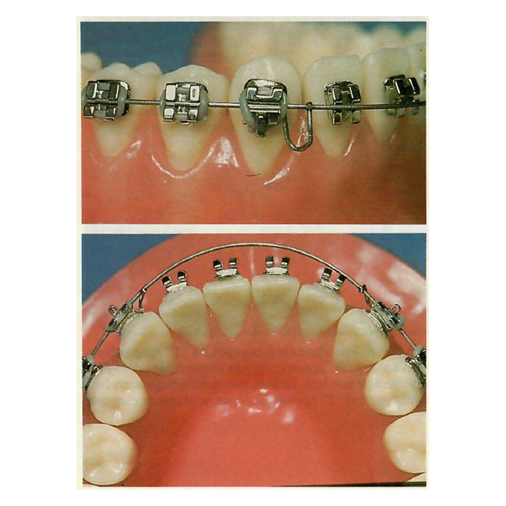 OSL TMA Straight Length Wires - Round (Pack Of 10)