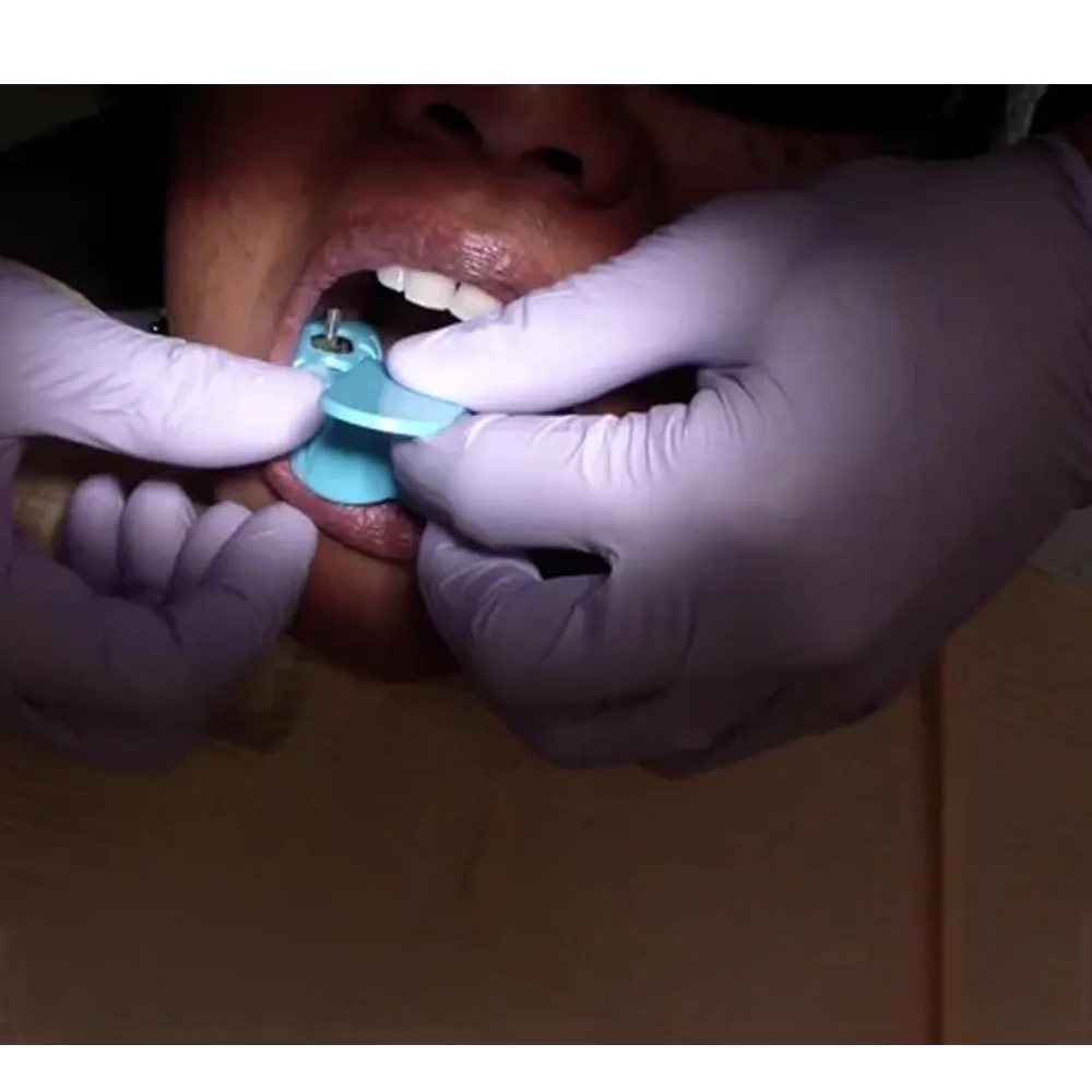 Adin RS Open Tray Slim Transfer