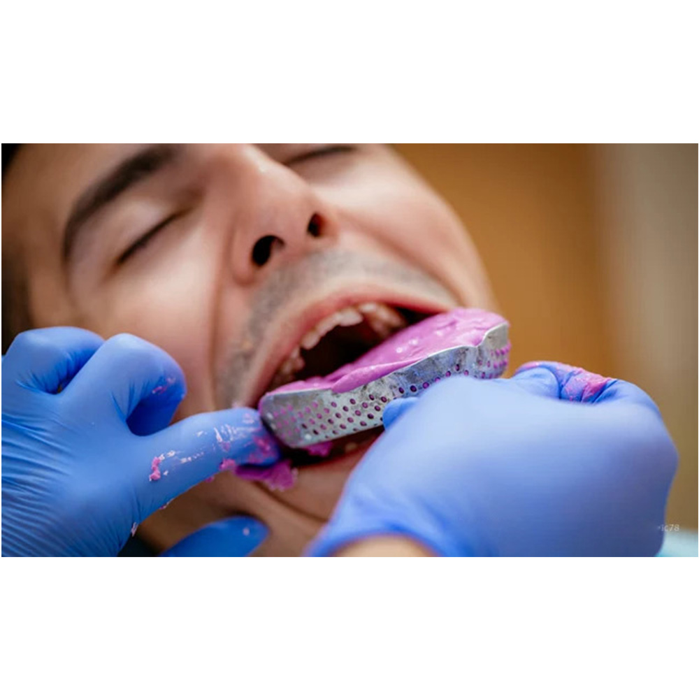 Gdc Impression Trays Dentulous Perforated