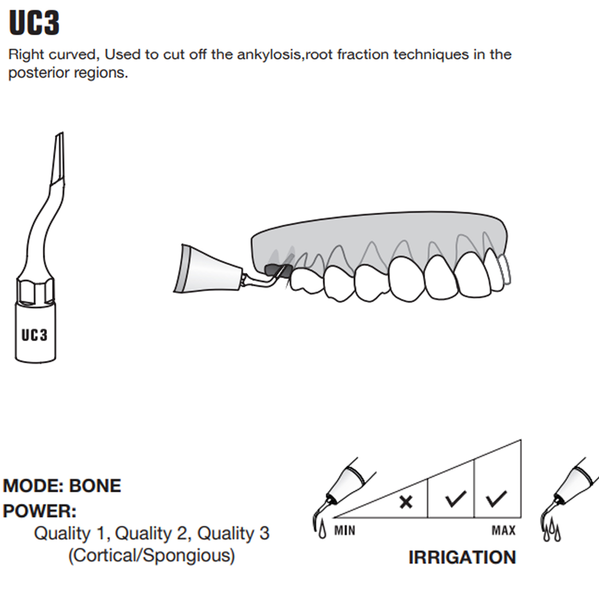 Woodpecker Piezo Bone Surgery Tips
