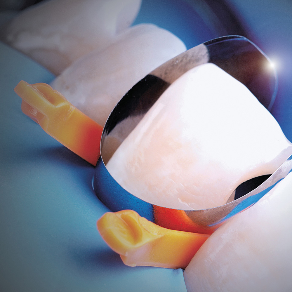 Polydentia Unica Anterior Matrix System Intro Kit