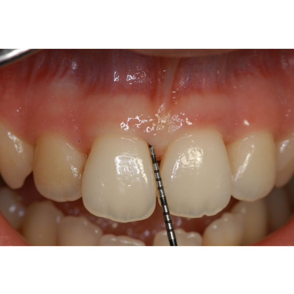 GDC University of North Carolina/William Premium - 6 (PCPUNC15/W6)