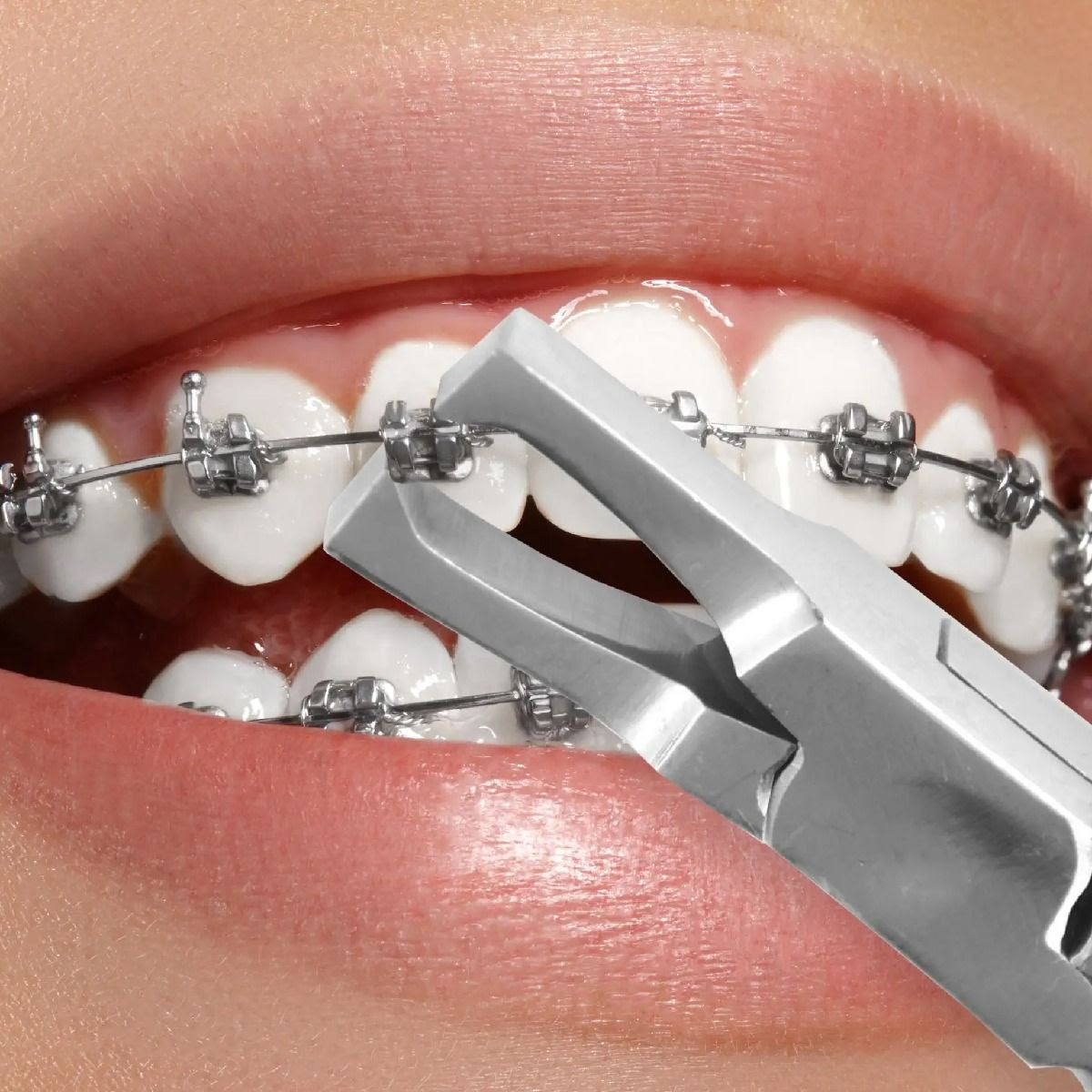 Oracraft Orthodontics Pliers