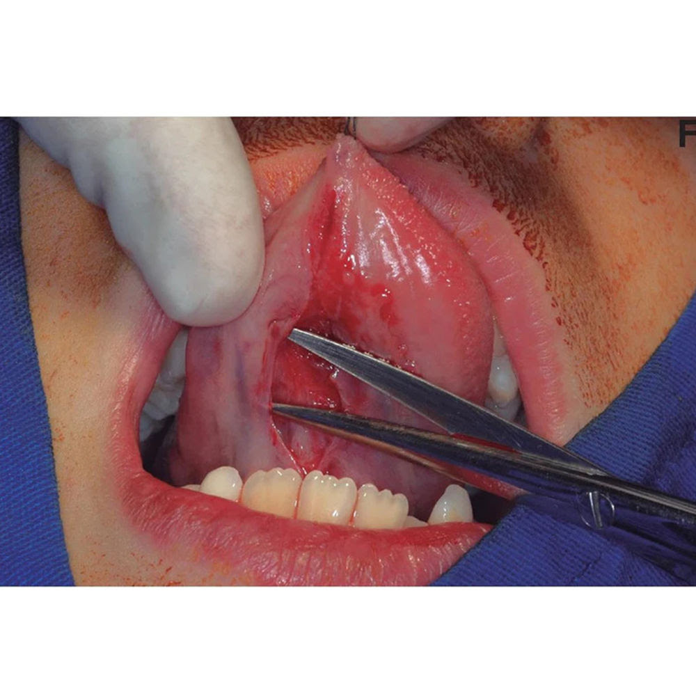 Oracraft Iris Scissors