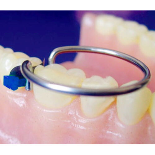 Tor Vm Add-On Fixing Wedges 40 Pcs (1.866)