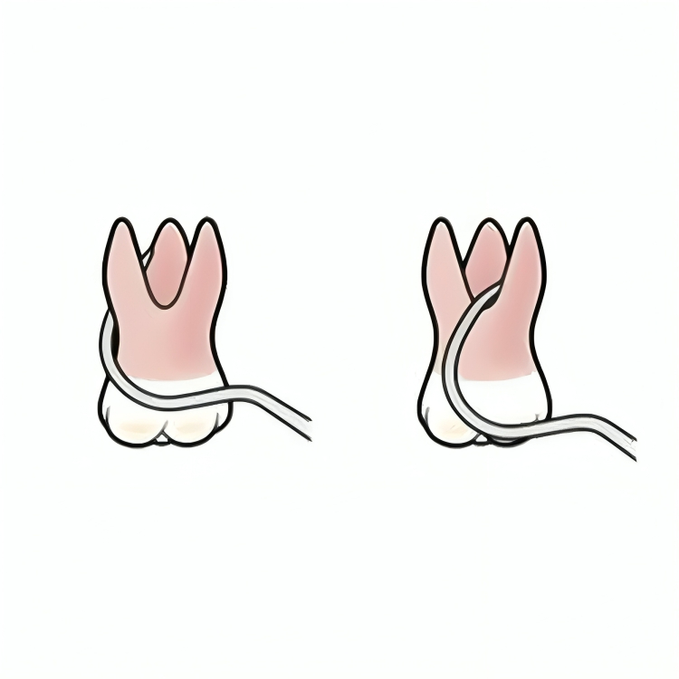 Oracraft Periodontal Probes
