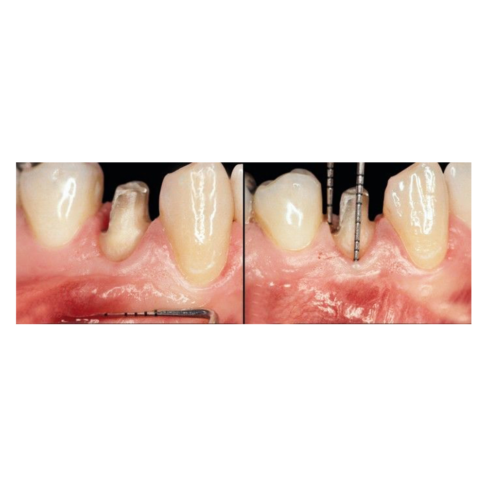 Waldent Conservative Instrument Kit of 20 (K15/1)