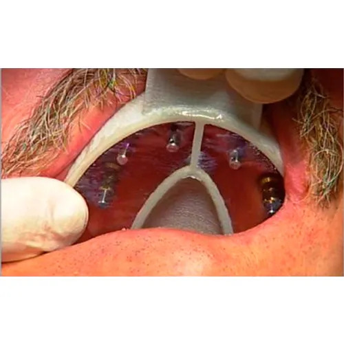 Cotisen Implant Impression Trays Set 