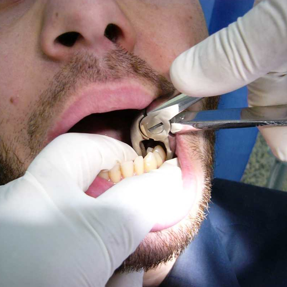 Waldent Extraction Forceps Kit Set of 12 (K1/1)     