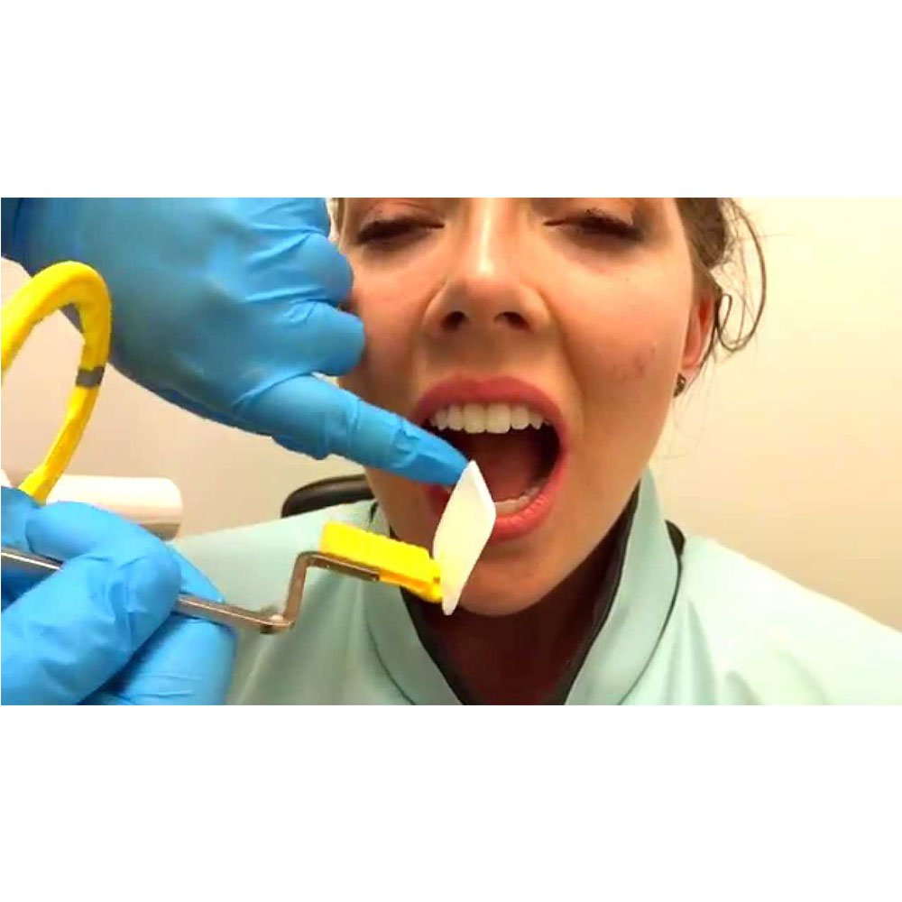 Waldent Dental X-Ray Film E-Speed (Pack Of 100)