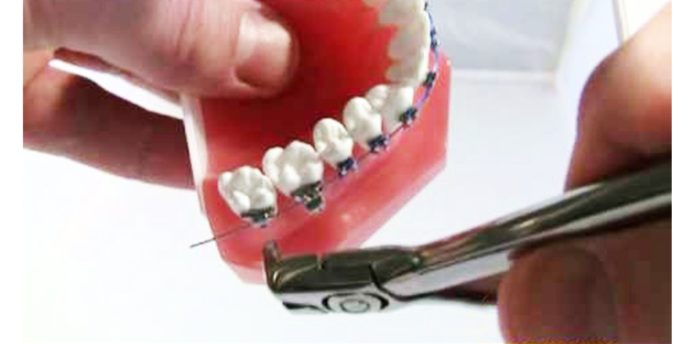 Waldent Distal End Cutter TC 10/102         