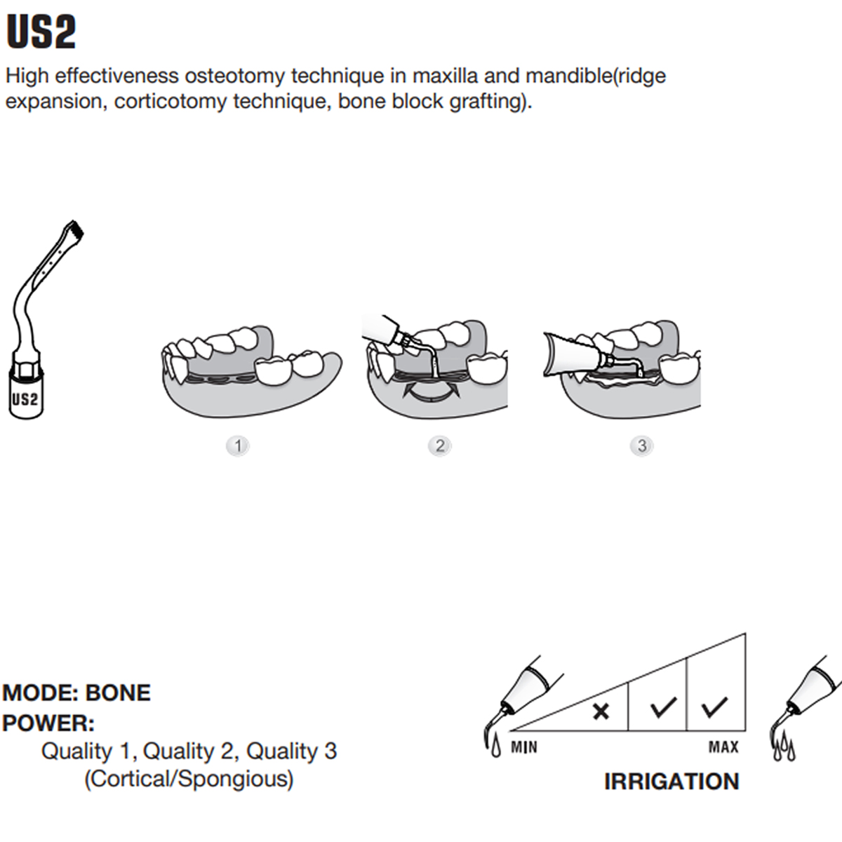 Woodpecker Piezo Bone Surgery Tips