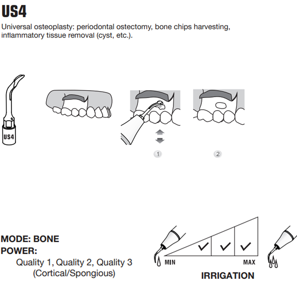 Woodpecker Piezo Bone Surgery Tips