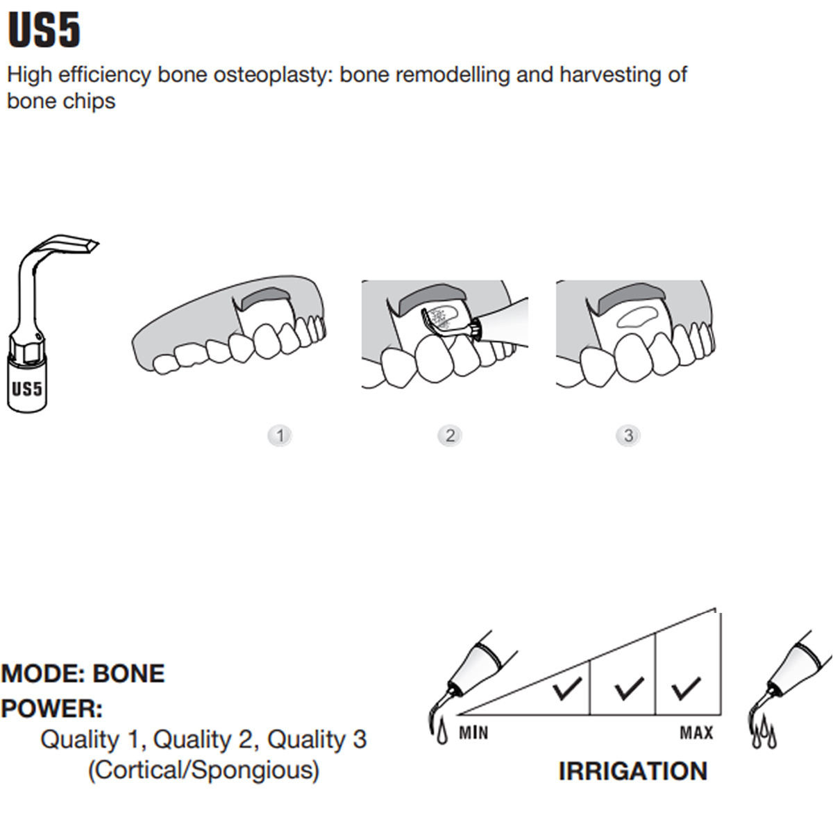Woodpecker Piezo Bone Surgery Tips