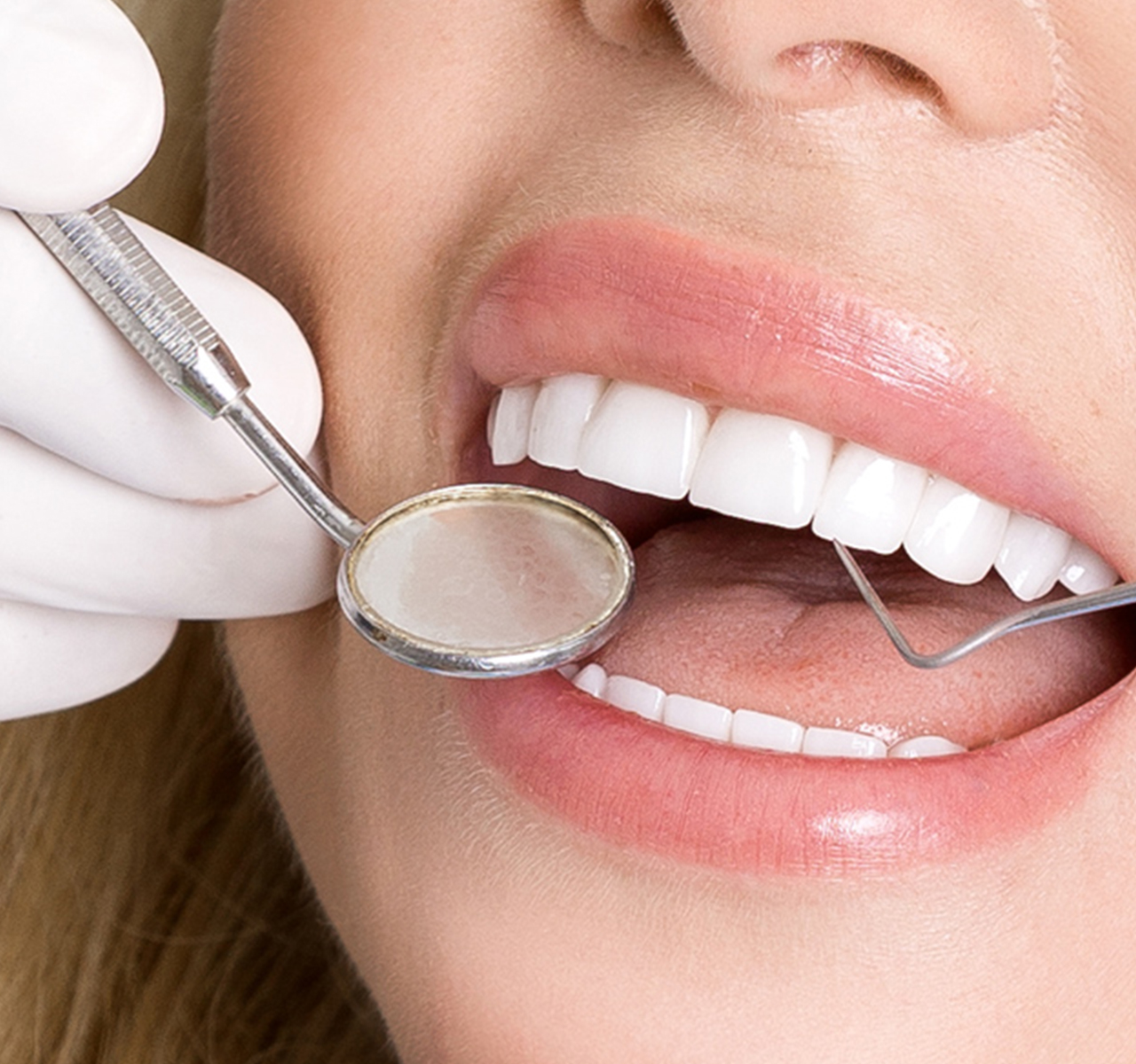 GDC Single End Probe -1 (Exs11)