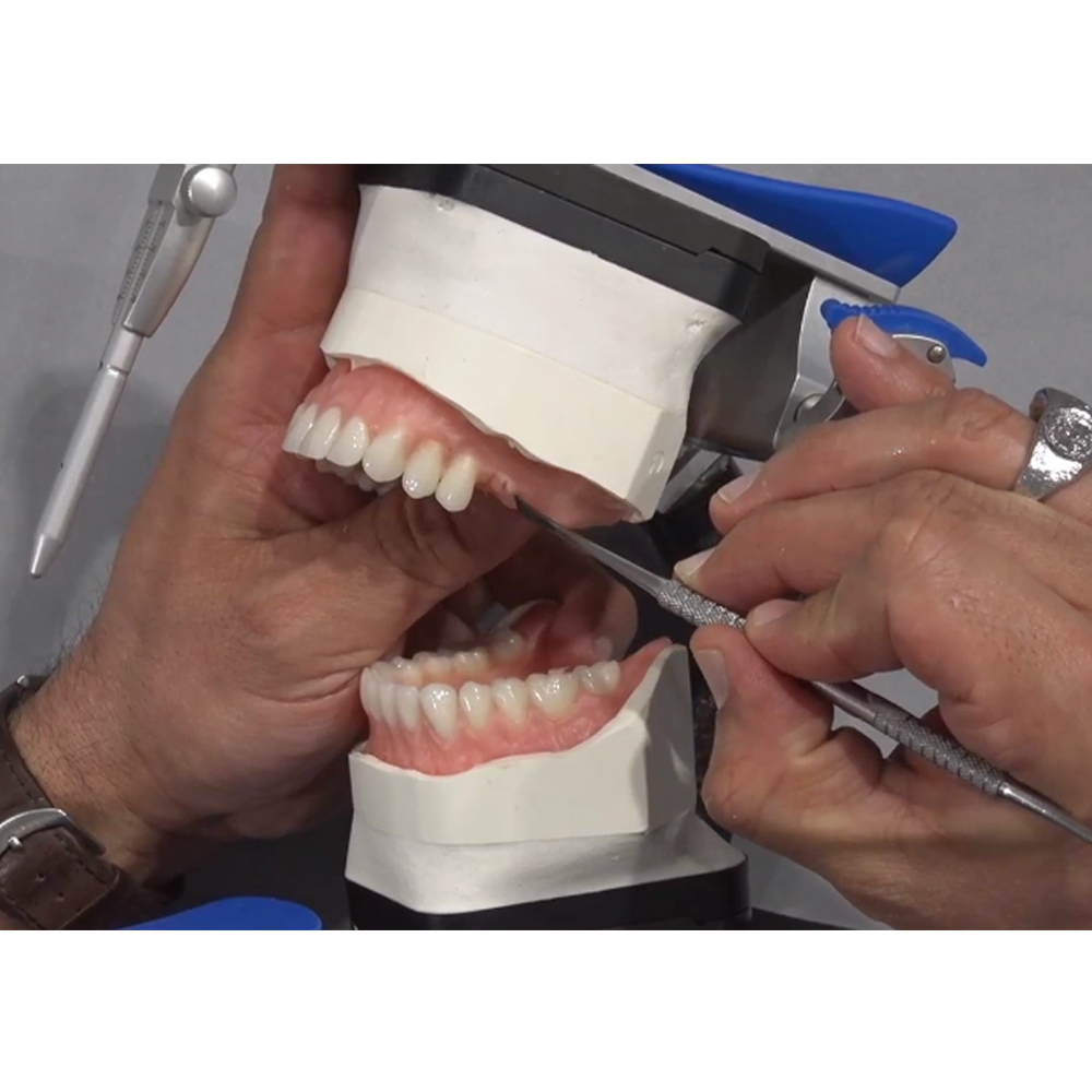 Huge Dental Bluebell Acrylic Denture Teeth A1 (Set of 28)