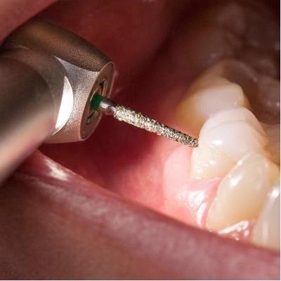 Endoking Myrotor LED Airotor And Cartridge