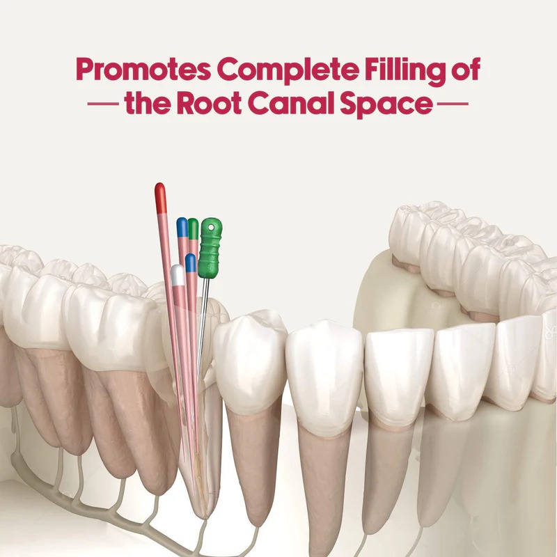 Mani Flare Finger Spreader 21mm