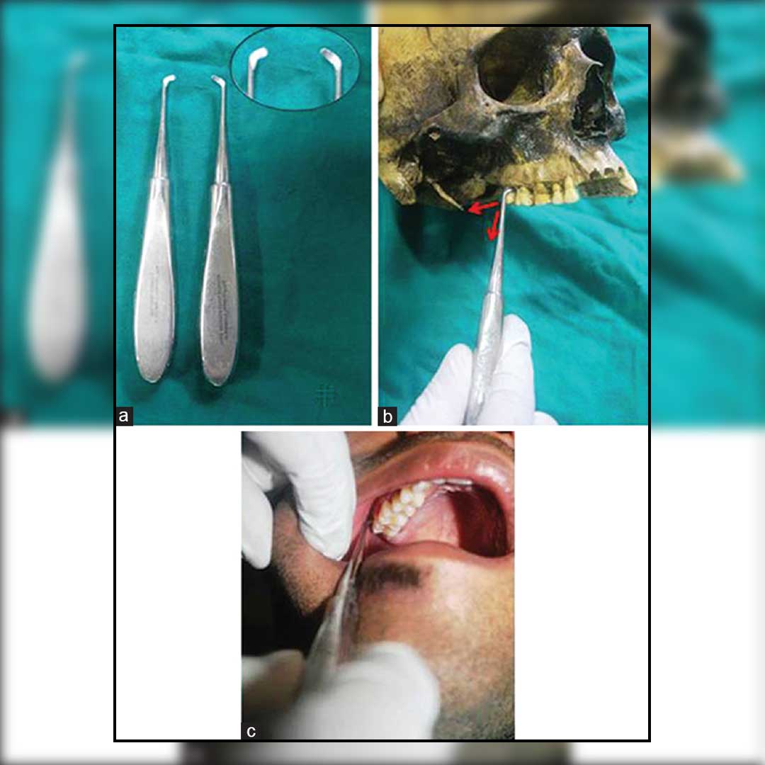 Waldent Root Elevators Warwick James Set of 3 (K2/3)