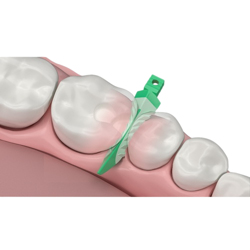 Garrison Dental Strata-G Wedges