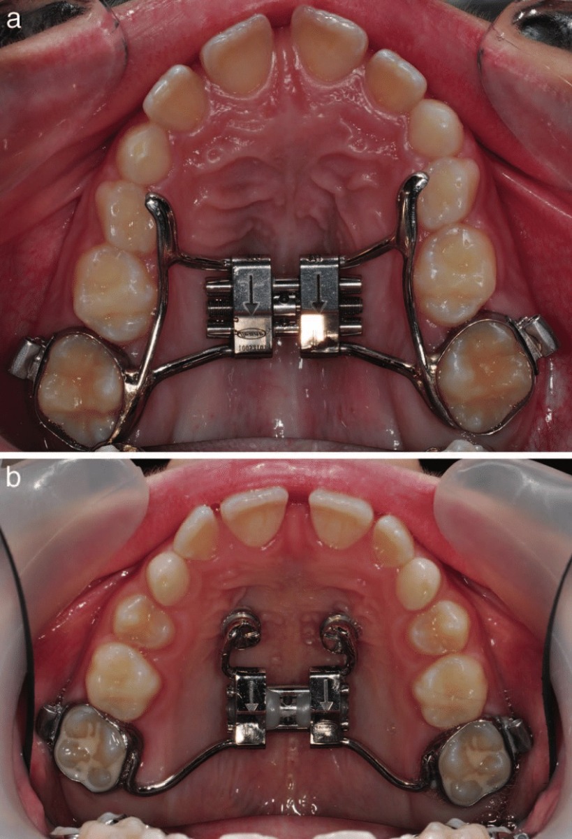LIFE Dental Mobilis-Double Pillar Trolley