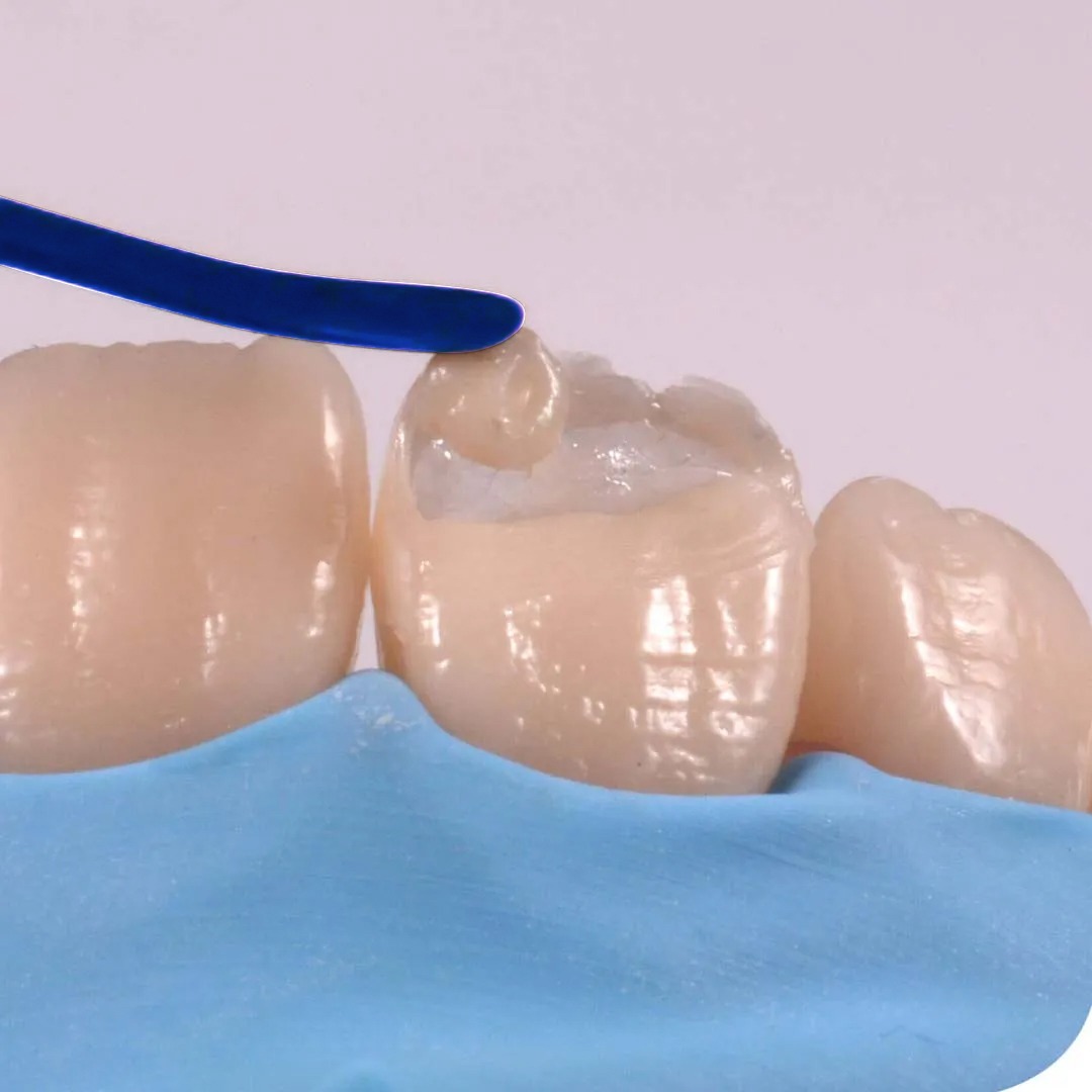 Waldent Plasma+ Composite Instrument Kit of 6 (K14/2)