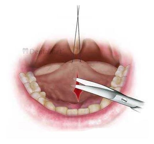 Waldent Oral Surgical Instruments Kit of 10 (K9/1)