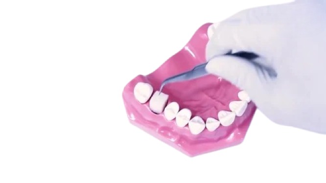 Xcem Osspore Gelatin Foams