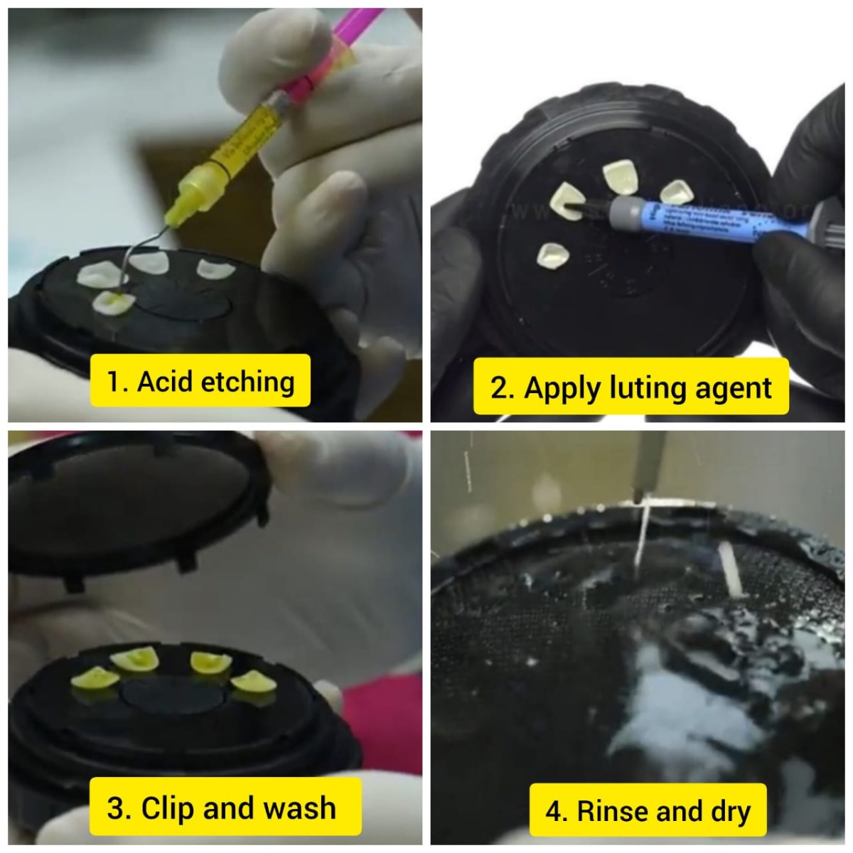 Younique Youni Smart Veener Box