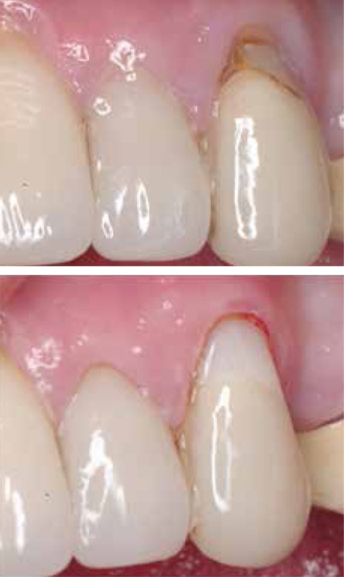 D-Tech Restore Glass GIC