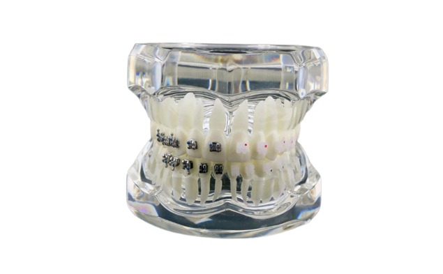 iDENTical Half Metal and Half Ceramic Brackets Orthodontic Models M3003