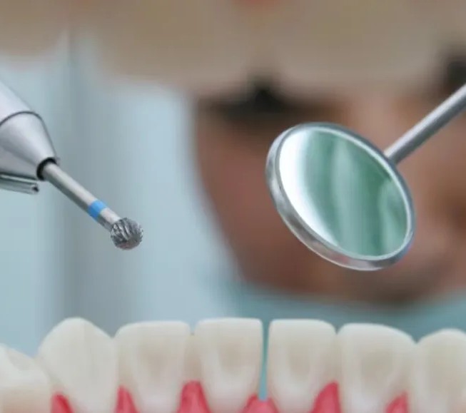 Prima Dental Round Bur Contra-Angle Carbide (Set of 5)