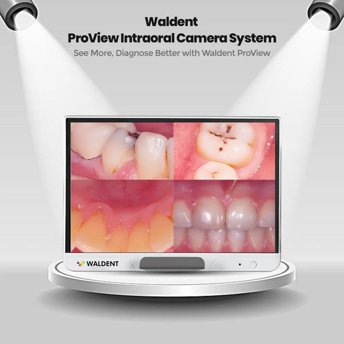Waldent ProView Intraoral Camera System