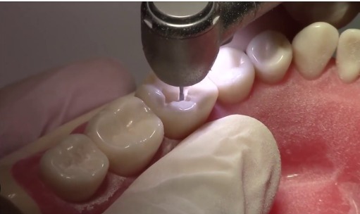 Being Foshan LED Airotor 401P-B2