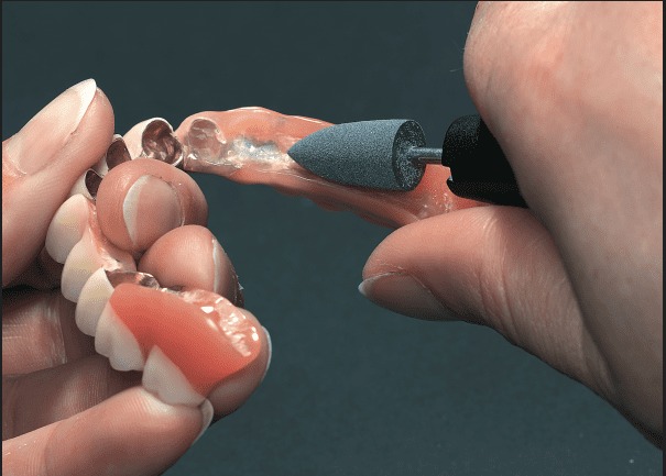 ET Dental Acrylic Polishers Points Blue Fine (Pack of 1)