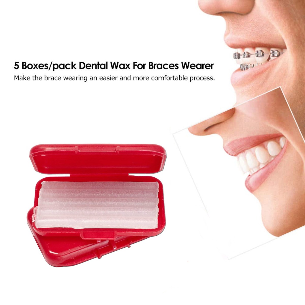 Sawbros Orthodontic Relief Wax (Pack Of 5)