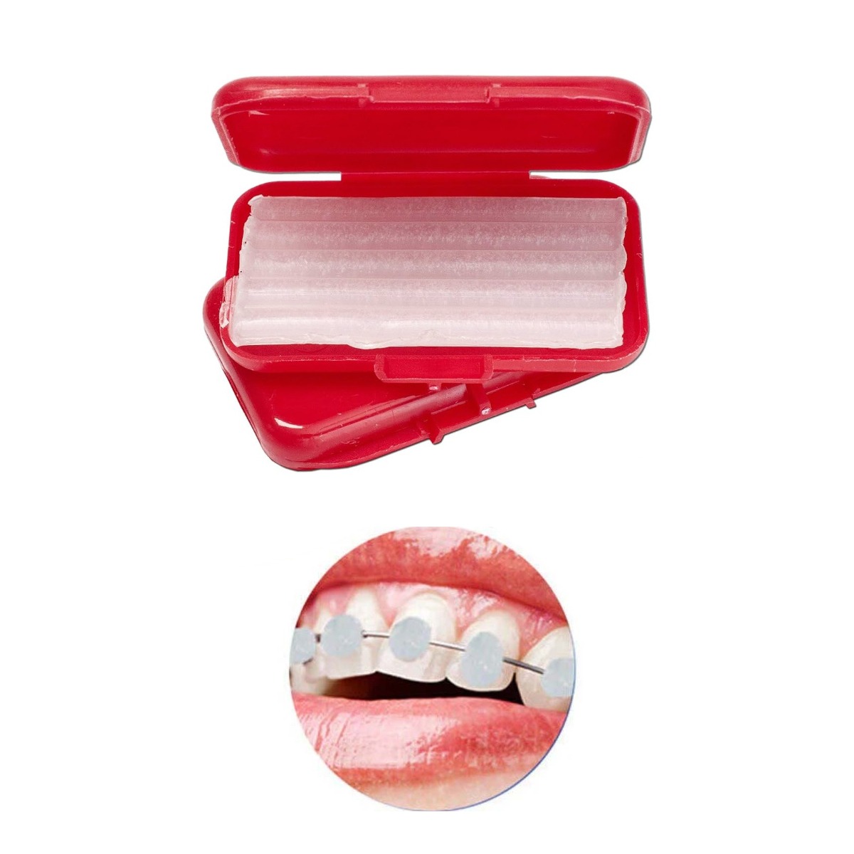 Sawbros Orthodontic Relief Wax (Pack Of 5)