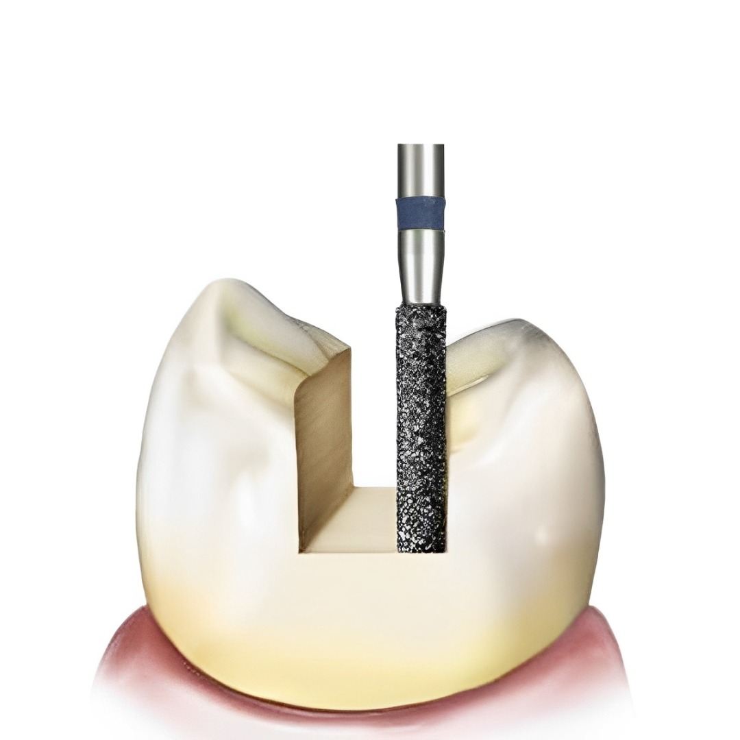 Frank Diamond Bur SF-11 | Made in Germany (Pack of 5)