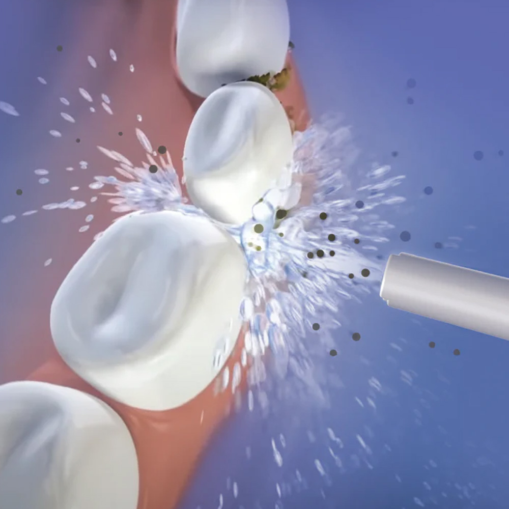 Oracura OC200 Dental PRO Smart Plus Water Flosser