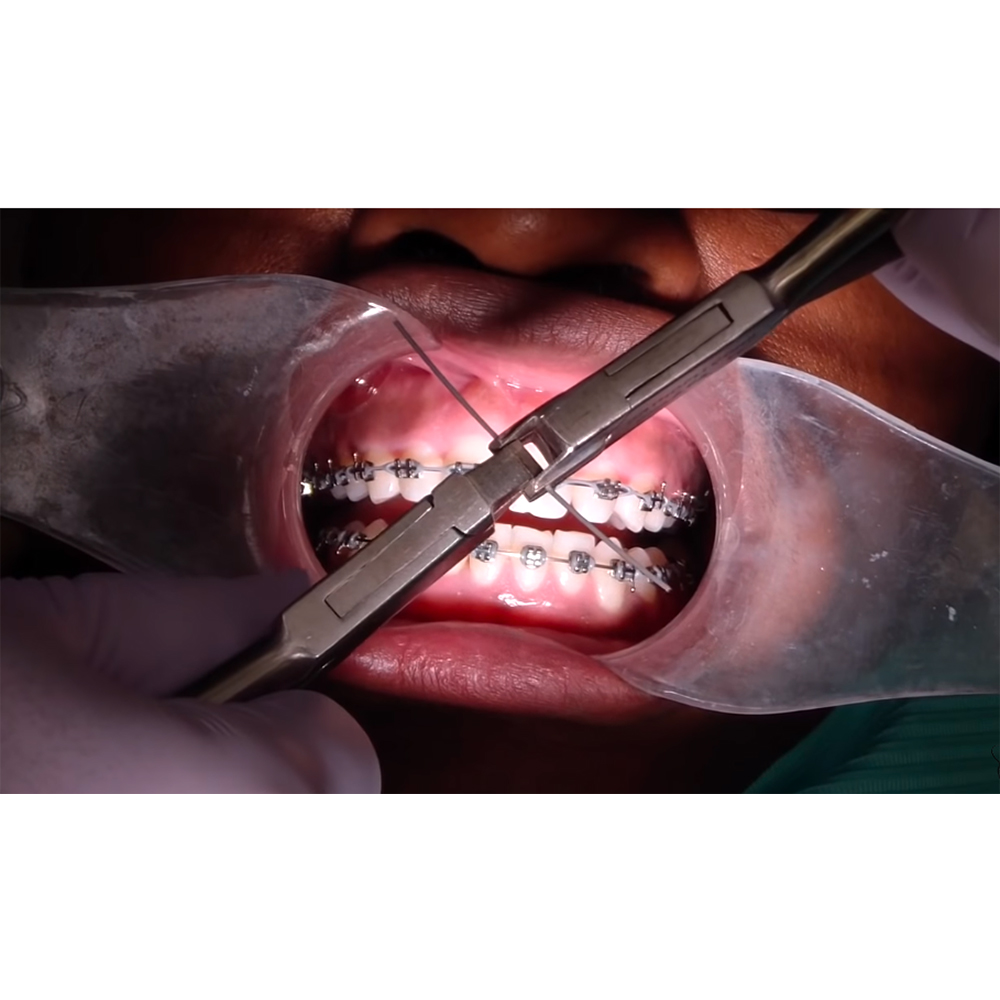 GDC Orthodontics Wire Bending Pliers