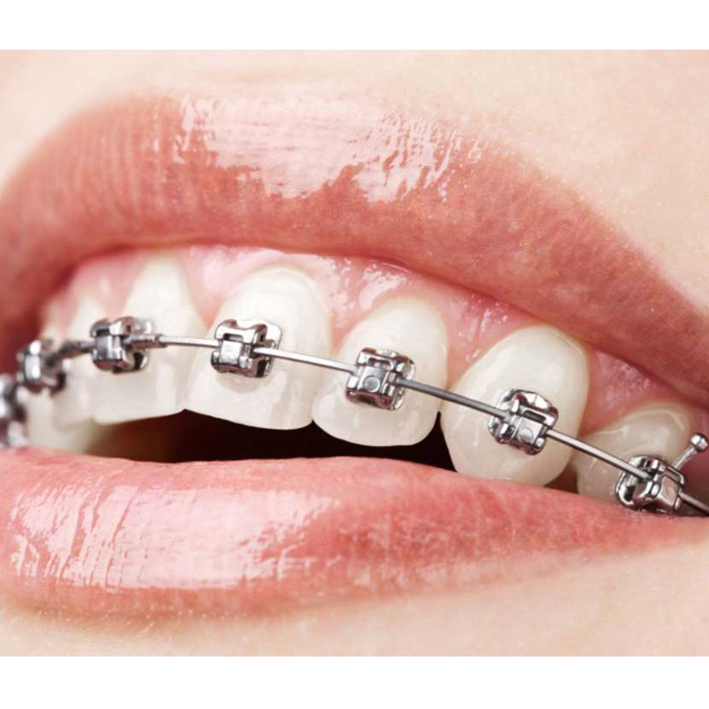 Fox Niti Preformed Wire Ovoidform (Pack of 10 Pcs)