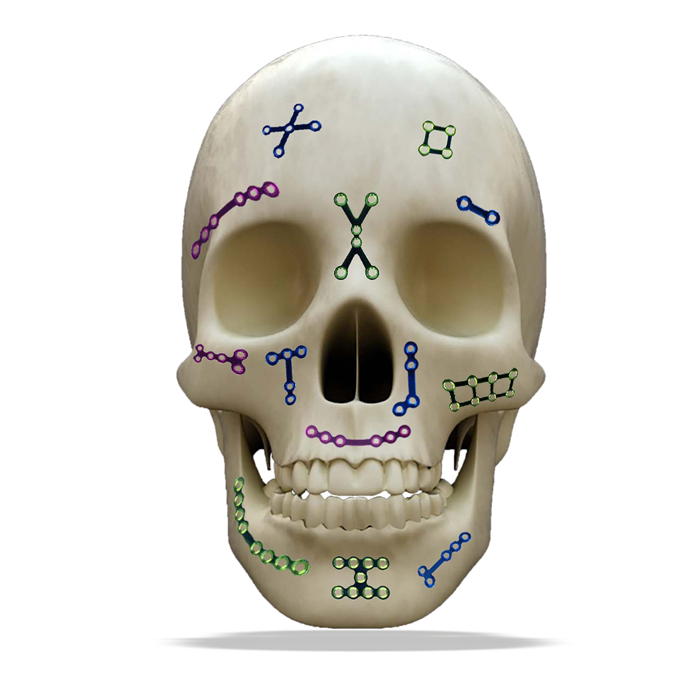 SK Surgicals Titanium Mini Bone Plates L Shape 120° With Gap - 1.5mm