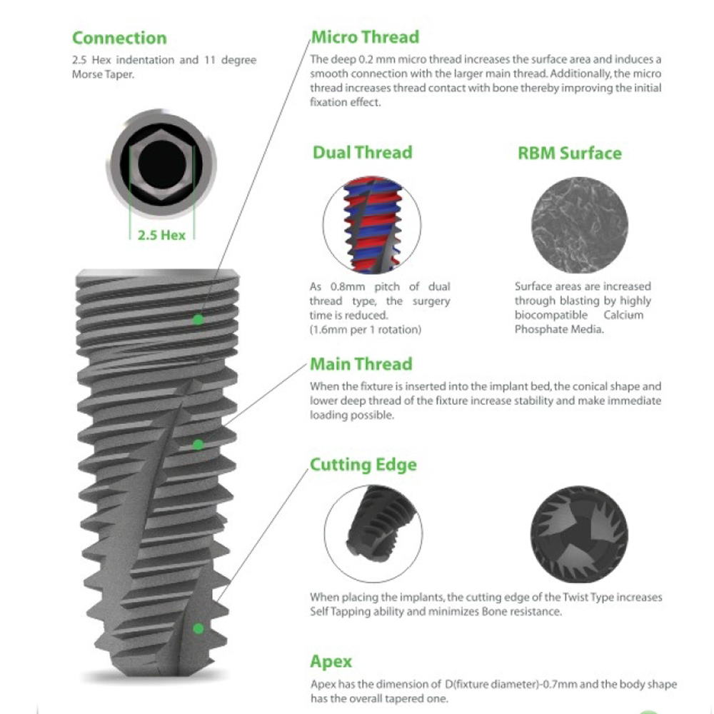 Xcem XE Submerged Dental Implant 5mm